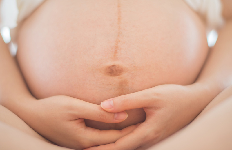 التغيرات الجلدية خلال فترة الحمل